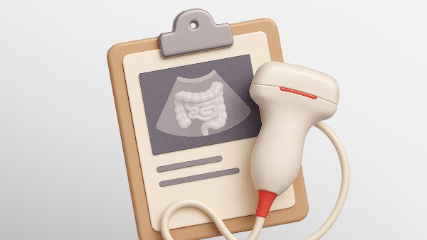 Чек‑ап «Здоровый кишечник»