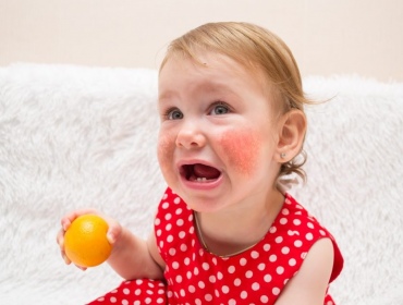 Опасность на тарелке. Как жить с пищевой аллергией у ребенка.