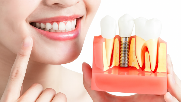 Скидка 9 000 ₽ на установку зубных топ-имплантов Дентиум (Корея)